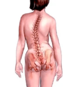 The pathology of the musculoskeletal system