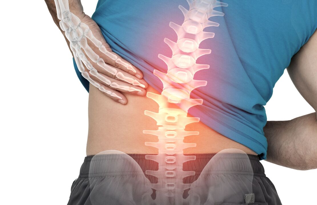 Dangers of lumbar ostechondrosis