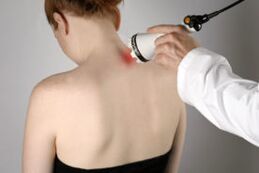 Treatment of cervical osteochondrosis with laser therapy