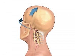 How cervical spinal osteochondrosis is shown on its own