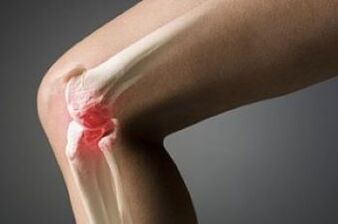 Arthrosis of the knee joint is a wound of cartilage tissue