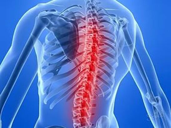 Diseases of the spine cause back pain