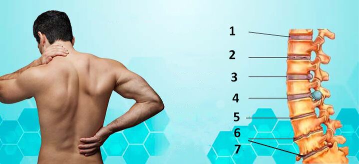 stage of development of osteochondrosis
